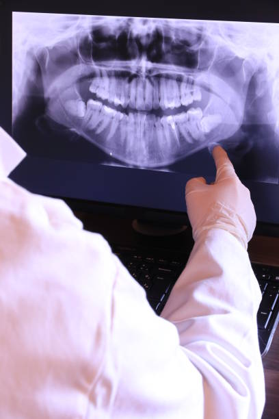 Best Emergency Dental Care for Abscessed Tooth in Forrest, IL